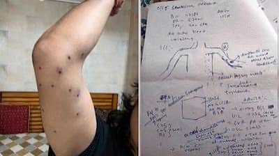 ছাত্র আন্দোলনে পেলেটগান বিতর্ক: সিআরপিএফের কাছে বিস্তারিত রিপোর্ট চাইল দিল্লি পুলিশ